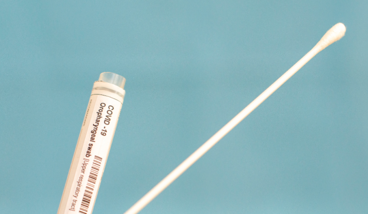 A medical swab and container for a COVID test.