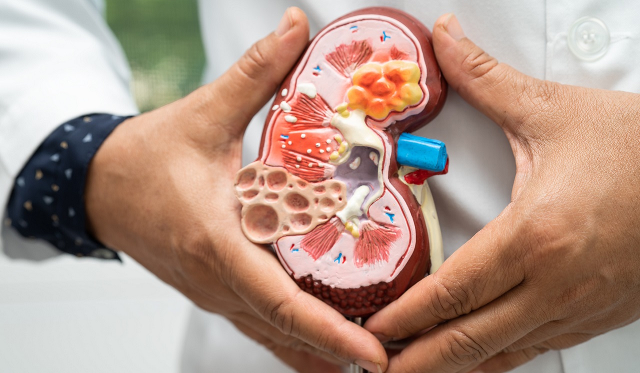 Example figure of a kidney