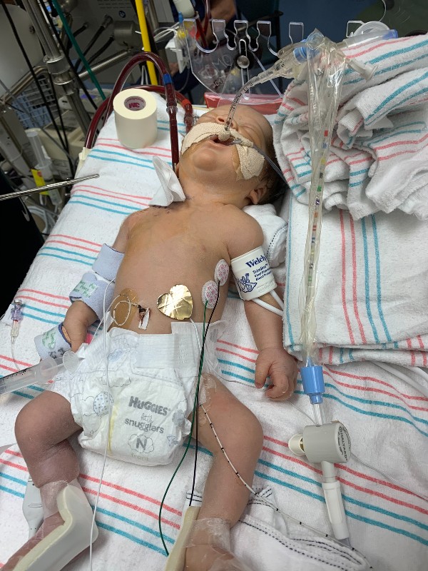 patient landon at nicu