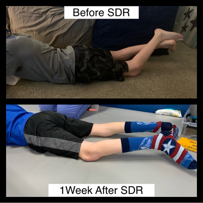 before and after sdr