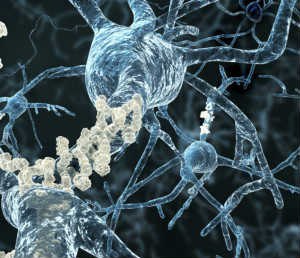 Amyloid Imaging