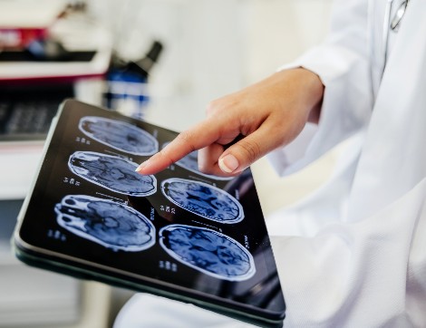 doctor pointing at brain scans