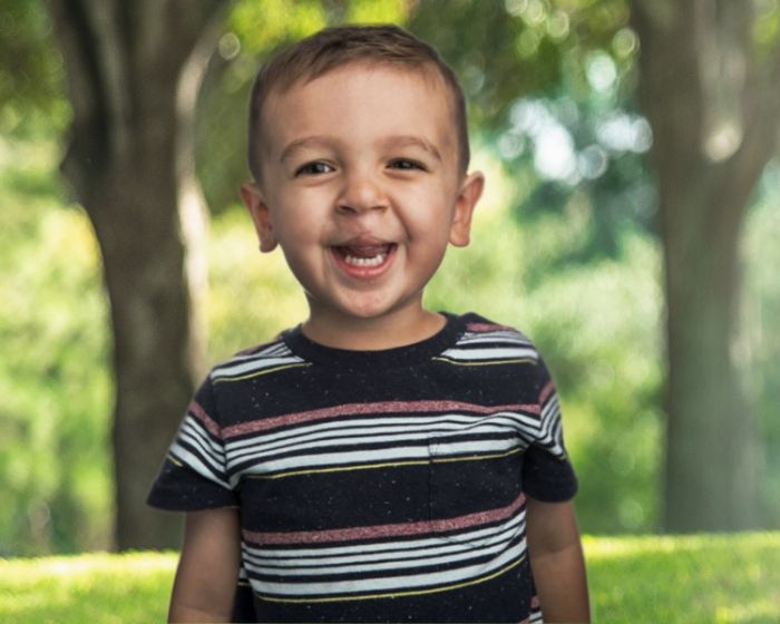 child smiling with cleft lip